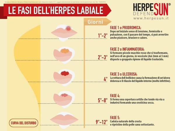 herpes labiale sintomi e cura dell'infezione 