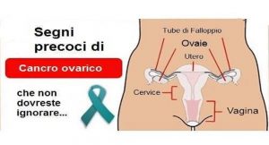 Cancro dell’Ovaio, Sintomi Da Non Trascurare