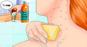aceto di mele pulizia viso