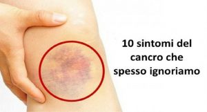 Guarire dai Tumori, 10 Sintomi che Spesso Vengono Ignorati